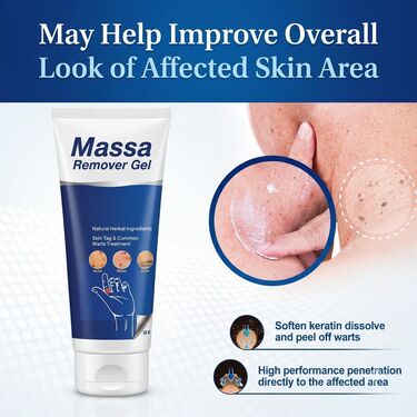 Massa Remover Gel (BCMR) – Advanced Skin Care Treatment for Clear, Smooth Skin