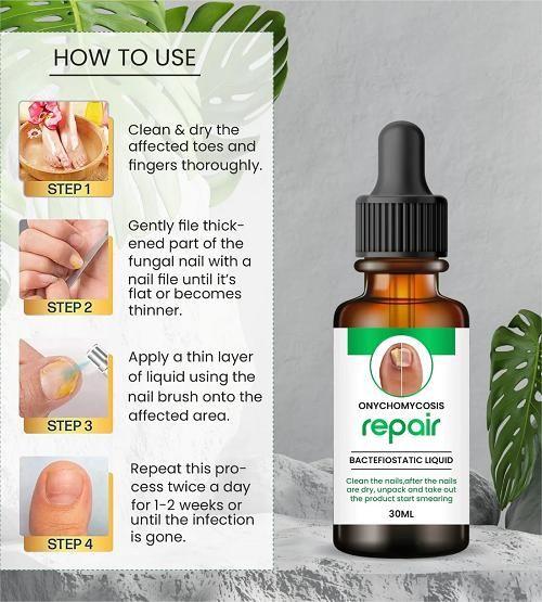 Nail Repair Serum (š¢Buy 1 Get 1 FREE) MAN & WOMAN