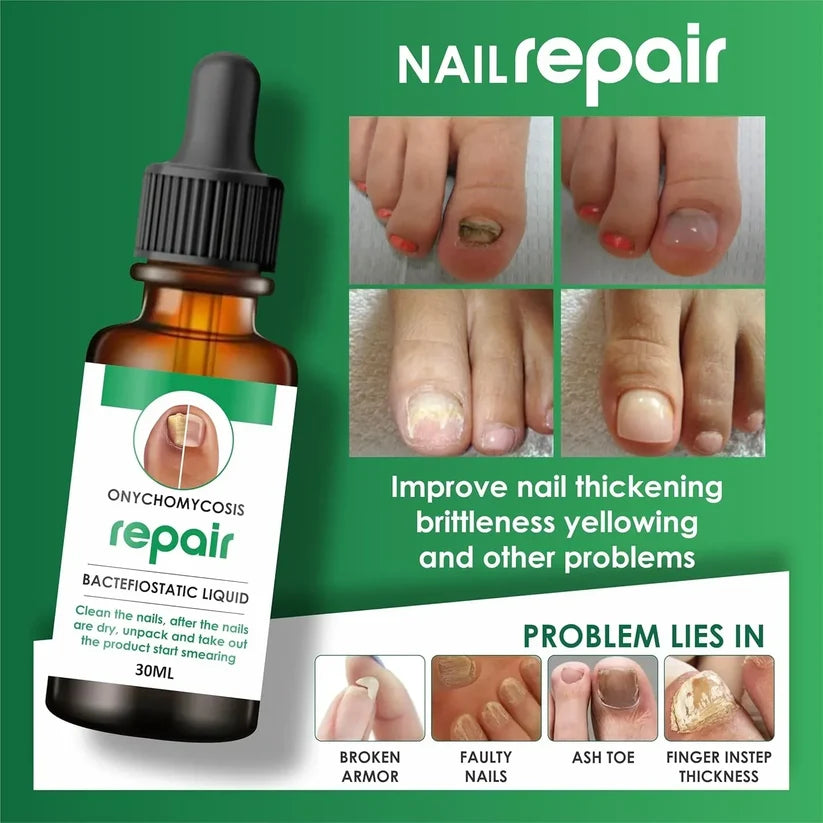 Nail Repair Serum (📢Buy 1 Get 1 FREE) MAN & WOMAN